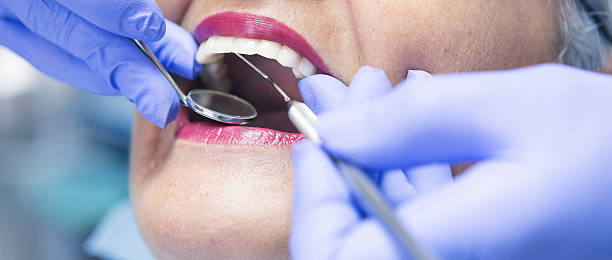 Best Emergency Dental Surgery in Beverly, OH